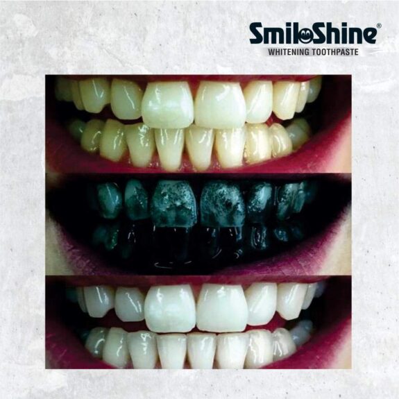 SmiloShine Whitening Toothpaste with Activated Charcoal - Image 3